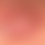Granuloma faciale: Detailed view. large lump with smooth surface. strikingly large and bizarre tu...