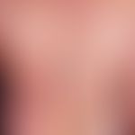 Psoriasis vulgaris chronisch-stationäre (Plaque-Typ): Unvorbehandelte, chronisch staionäre&nbsp;P...