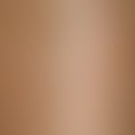 Stucco keratosis: flat, longstanding and multiplying, non-reactive, scaly, depigmented patches in...