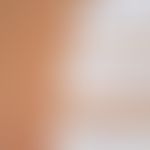 Heparinallergie: positive Epikutan-Testreaktionen &nbsp;(Abbildung: PD. H. Dickel Univ-Hautklinik...