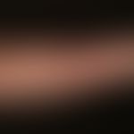 Dermatose, IgA-lineare. 29-Jährige Ptientin; seit mehreren&nbsp; Monaten rezidivierendes, vesikul...