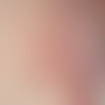 Herpes simplex infection: vulvovaginitis herpetica with as a first manifestation of a herpes simp...