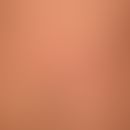 Larva migrans: after a tropical beach holiday several weeks ago, at times clearly itchy, still in...