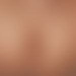 Larva migrans. itchy disease of an infant. occurred after a stay in kenya 1 week ago. several, at...