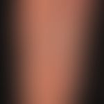 Larva migrans. linear plaque, subepidermally located, tortuous itchy duct through Ancylostoma bra...