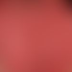 Lingua plicata: idiopathische Form, keine Grunderkrankung bekannt.&nbsp;
