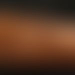 Lipoatrophie, lokalisierte nach mehrfachen Glukokortikosteroid-Injektionen wegen Bursitis. Mit Pf...