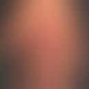 Mycobacterioses, atypical: reddish-brown, blurred, lichenified, hardly scaly plaque that has been...