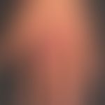Mycobacterium marinum/Mykobakteriosen, nichtuberkulöse (atypische): seit mehreren Monaten bestehe...