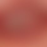 Hämangiom des Säuglings: 3 Monate alter Säugling. Innerhalb 1 Woche flächige Nekrose der zentrale...