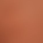 Kaposi's sarcoma endemic: Detailed picture with arrangement of the sarcomas in the tension lines ...