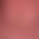 Keratosis areolae mammae als Nebenwirkung einer Therapie mit&nbsp;Vemurafenib (s.a. dort).

