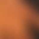 Keratosis palmoplantaris diffusa circumscripta: Dicke, wachsartige, gelbliche, plattenartige Horn...