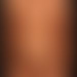 Naevus verrucosus (Serie): Kontrolle im 8. Lebensjahr.
