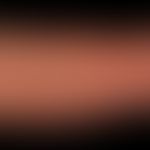 UV-Strahlen: Chronischer UV-Schaden mit enormer Voralterung der Haut (Streckseite des Unterarms),...