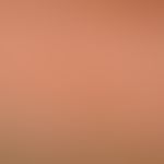 Lichen myxoedematosus: Densely standing, skin-colored, also light-glassy appearing, clearly incre...