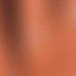 Psoriais of the hands: Chronic persistent, sharply defined, hyperkeratotic plaques with whitish s...