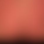 Schuppen: Großlamelläre Schuppung bei erythrodermischer Psoriasis. &nbsp;
