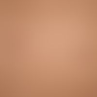 POEMS Syndrome: Multiple capillary hemangiomas which were already detectable in large numbers in ...