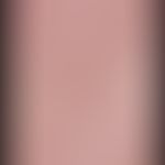 Sebaceous gland hyperplasia, senile. 74-year-old patient noticed these completely asymptomatic sk...