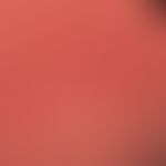 Teleangiectasia macularis eruptiva perstans. Detailaufnahme. Seit Jahren langsam progrediente "Ha...