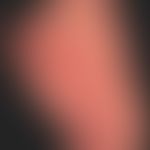 Teleangiectasia macularis eruptiva perstans. Seit Jahren langsam progrediente "Hautrötung" die si...