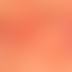 Basal cell carcinoma nodular (detailed picture), characterized by the bizarre "tumor vessels" mar...