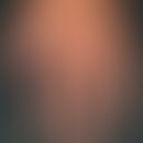 Psoriasis palmaris (as partial symptom of a generalized poriasis): Subungual infection of the lef...