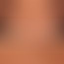 Pityriasis versicolor alba: vertikale Pfeile bezeichen die befallene &nbsp;(depigmentierte) Haut....