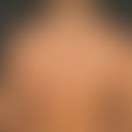 Keloide:&nbsp;seit der Pubertät bekannte inzwischen abgeheilte Acne vulgaris. Seit Monaten Entwic...