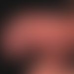 lichen sclerosus of the penis: encircled, several discrete, veil-like, little sharply defined, wh...