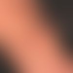 Lymphomatoid papulosis of the flexor-sided forearm; within a few weeks a red, painless lump devel...