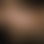 Tinea capitis superficialis: non-inflammatory, blurred, alopecic foci in the parting area in a 6-...