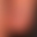 Nagelorgan mit erklärten anatomischen Strukturen
