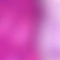 Pityriasis versicolor alba: masses of spores detectable in the stratum corneum of the epidermis (...
