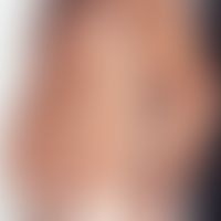 Pityriasis rosea:&nbsp;stammbetontes, in den Hautspannungslinien angeordnetes (s.folgende Abb.),&...