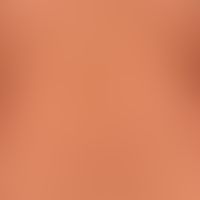 Pityriasis lichenoides chronica:&nbsp;seit mehreren Monaten bestehendes, mässig juckendes, dichte...