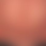 Pityriasis rubra pilaris (adult type) Detail: chronic recurrent course for years with phases of m...