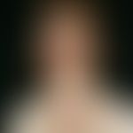 Pityriasis rubra pilaris (adult type): Flat, pityriasiform scaly yellow-reddish, sharply defined,...