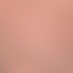 Pediculosis corporis: Detail enlargement: numerous ectoparasites recognizable as dark spots, whic...