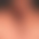Pemphigus vulgaris: seit Monaten rezdivierendes Krankheitsbild. Vordergründig finden sich nässend...