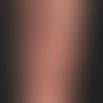 Papillomatosis cutis lymphostatica: Flächenhafte,&nbsp;nach allen Seiten nur unscharf begrenzte, ...