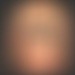 Pemphigoid gestationis. Heftig juckendes, seit 4 Wochen bestehendes &nbsp;Exanthem mit multiplen,...