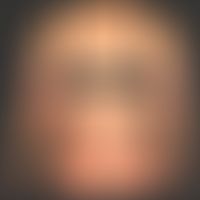 Pemphigoid gestationis: Intensely itching exanthema since 4 weeks with multiple, generalized, sym...