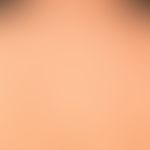 PEP: multiple, massively itchy urticarial papules, also papulo vesicles; firstborn, last trimeste...