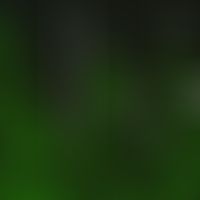 Porphyria cutanea tarda: Detailaufnahme mit linearen Ablagerungen von Fibrinogen an der Basalmemb...
