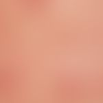 Psoriasis guttata. Kleinherdige, exanthematische Form der Psoriasis nach Streptokokkeninfekt. Nur...