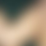 Incontinentia pigmenti, Typ Bloch-Sulzberger. Girlandenförmige Pigmentierung am Oberschenkel im V...
