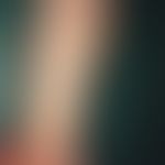 Incontinentia pigmenti, Typ Bloch-Sulzberger. Girlandenförmige Pigmentierung am Unterarm im Verla...