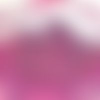 Pustulose akute generalisierte exanthematische: subkorneale Pustel mit neutrophilen Granulozyten....
